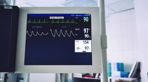 recuperacion monitor cardiaco-unsplash