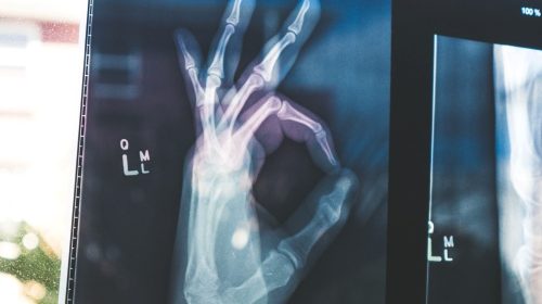 bien-ok-seguro-unsplash